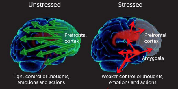 brainrot
